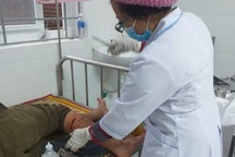 Bị voọc gáy trắng hung hãn tấn công, người đàn ông phải khâu 8 mũi