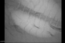 Lươn chui khỏi bụng cá sau khi bị nuốt