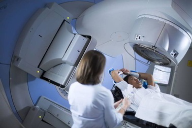 Bệnh nhân ung thư phổi khi xạ trị có thể gặp những tác dụng phụ nào?