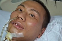 Ám ảnh đôi mắt khát thèm sự sống của chàng trai bị ngã từ tầng 5 xuống đất