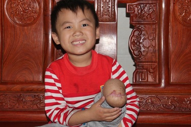 Giá bồi thường nào cho đủ với cháu bé 5 tuổi bị cột viễn thông đè nát chân?