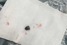 Bắt nghi phạm dùng súng tự chế bắn tài xế ở Đồng Nai