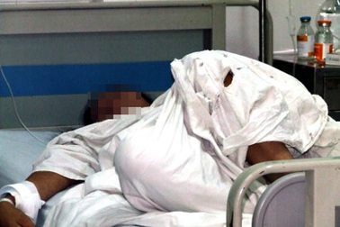 Nghi án thiếu phụ liệt nửa người bị “bạo dâm” giữa đêm