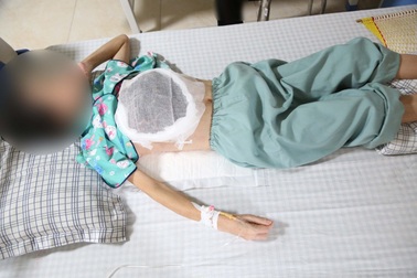 Khối u vỡ chảy mủ, nhiễm độc sau khi chữa ở thầy lang