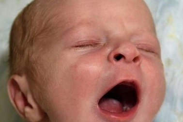 Đi khám thận bất ngờ phát hiện... có thai 9 tháng