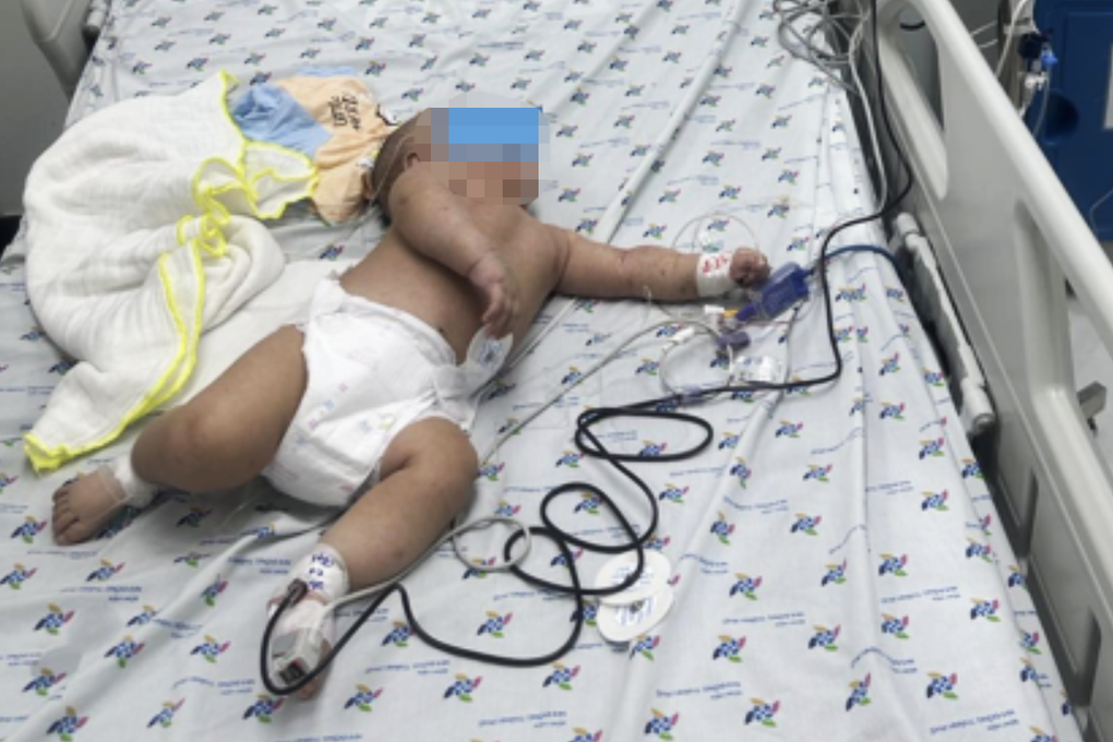 Bé trai nhiễm sốt xuất huyết nguy kịch nhưng 2 nơi chẩn đoán tay chân miệng - 1 Bé trai nhiễm sốt xuất huyết nguy kịch nhưng 2 nơi chẩn đoán tay chân miệng - 1