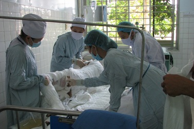 Một bệnh nhân bỏng nặng do cháy nhà