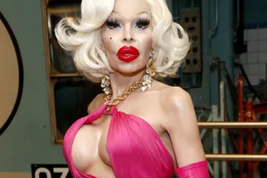 Gương mặt ngày càng "biến dạng" của người mẫu chuyển giới