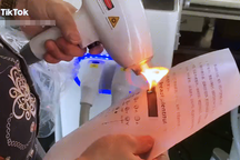 Nhiều ca laser thẩm mỹ bị tai biến vì "máy bắn cháy giấy"