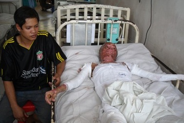 Hạnh phúc mong manh của nạn nhân vụ nổ bình dầu