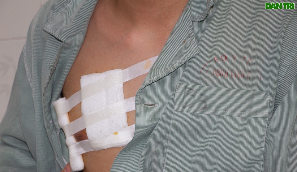 Hà Nội: Nam sinh 17 tuổi dũng cảm bắt cướp giúp bạn bị đâm rách phổi - 1 Hà Nội: Nam sinh 17 tuổi dũng cảm bắt cướp giúp bạn bị đâm rách phổi - 1