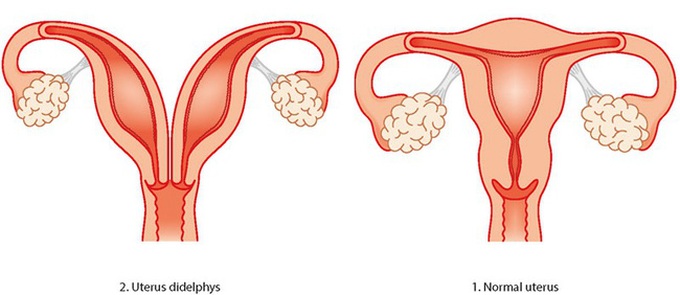 Vừa sinh con được 26 ngày, bà mẹ bị "chảy nước" ào ạt, các bác sĩ choáng váng khi tiếp tục đón thêm một cặp song sinh nữa chào đời - Ảnh 2. Vừa sinh con được 26 ngày, bà mẹ bị "chảy nước" ào ạt, các bác sĩ choáng váng khi tiếp tục đón thêm một cặp song sinh nữa chào đời - Ảnh 2.