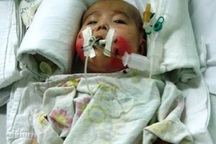 Bé Nhân Ái đã giảm được 30% virus nhiễm trùng máu