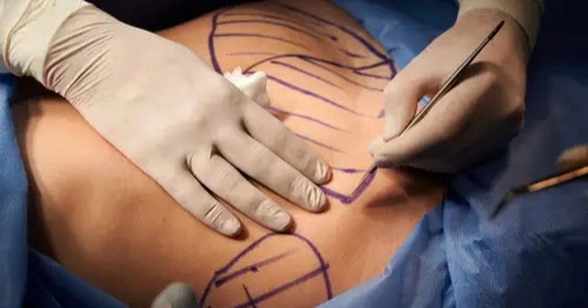Nam giới chi hàng chục nghìn USD "dao kéo" để có cơ bụng 6 múi