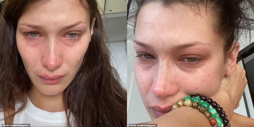 Siêu mẫu Bella Hadid bất ngờ chia sẻ loạt ảnh đẫm nước mắt - 1 Siêu mẫu Bella Hadid bất ngờ chia sẻ loạt ảnh đẫm nước mắt - 1