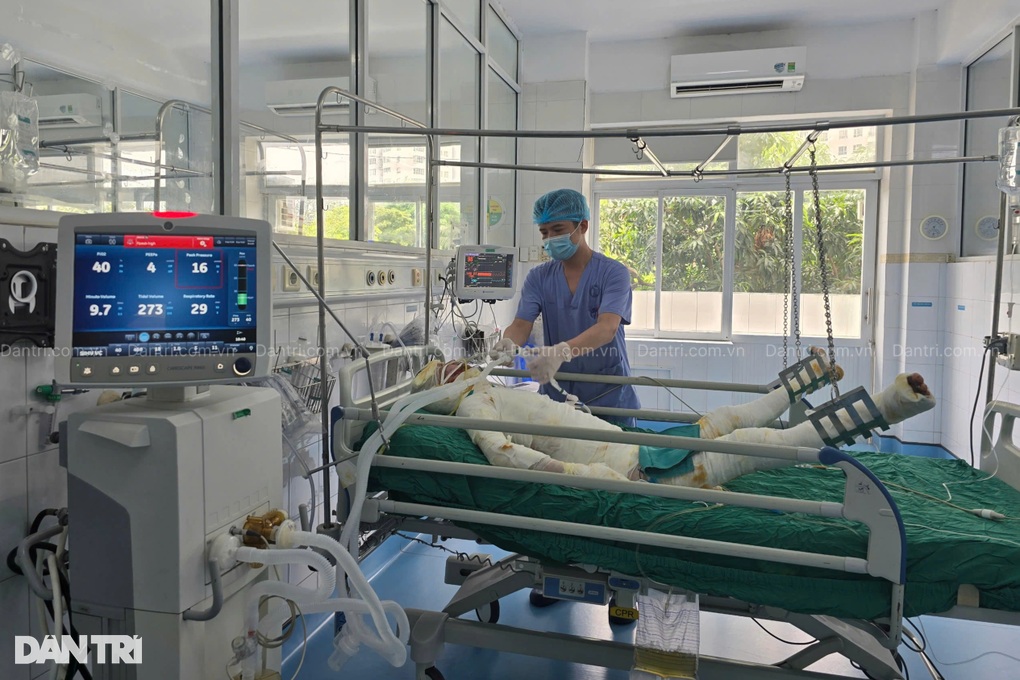 Bác sĩ kêu gọi cứu chàng trai dân tộc Mông nguy kịch vì bỏng điện - 1 Bác sĩ kêu gọi cứu chàng trai dân tộc Mông nguy kịch vì bỏng điện - 1
