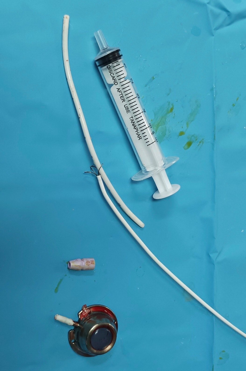 Lấy dị vật kẹt trong tim cho người bệnh ung thư vú - 2 Lấy dị vật kẹt trong tim cho người bệnh ung thư vú - 2