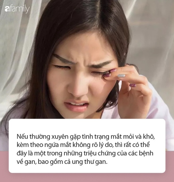 Những người có gan kém sẽ có 3 bất thường trong mắt - Ảnh 1. Những người có gan kém sẽ có 3 bất thường trong mắt - Ảnh 1.