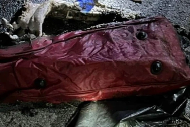 Vụ 2 chân bị cháy xém ở Bình Dương: Bộ Công an vào cuộc điều tra