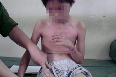 Vụ đốt con vì tội ăn cắp: Người bố xin công an cho về… lấy vợ hai