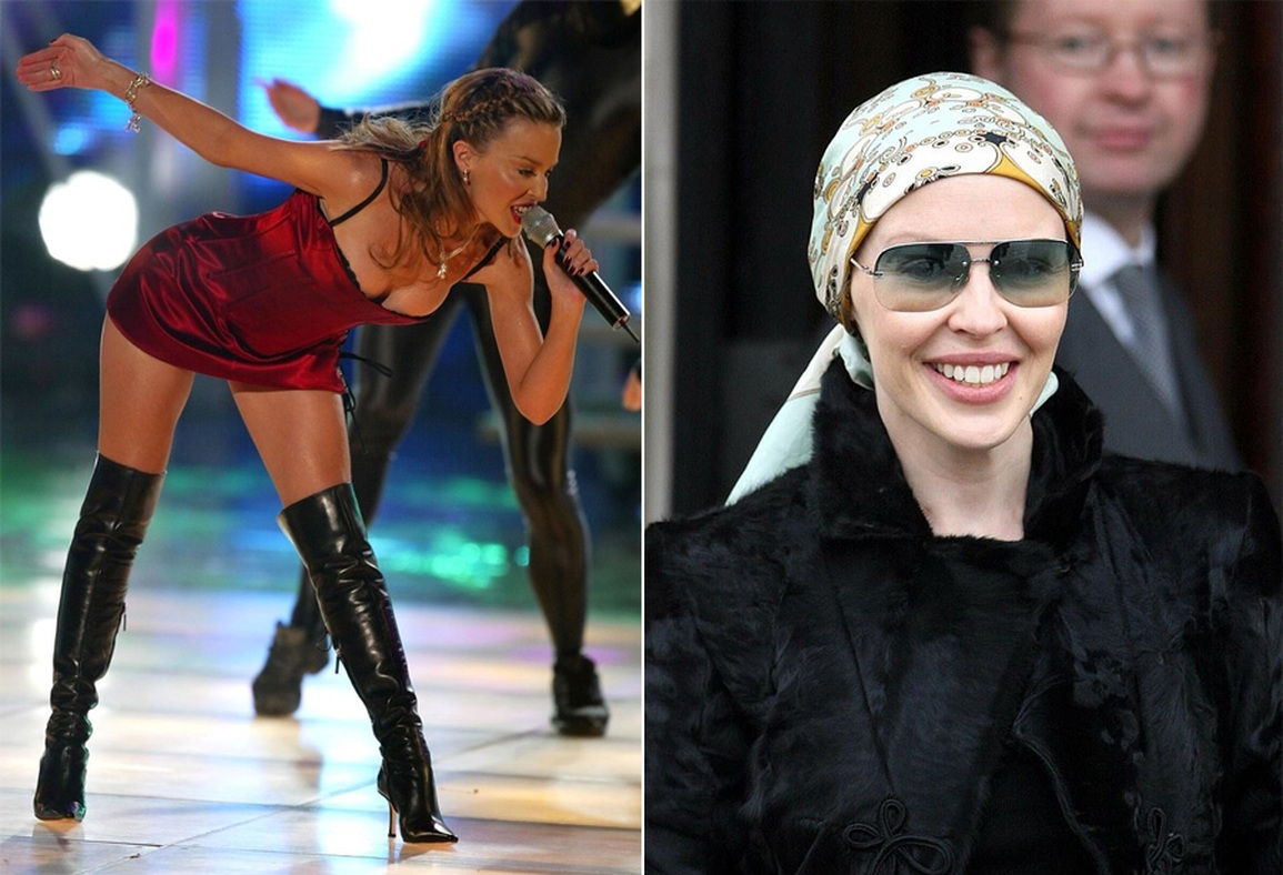 Diva Australia Kylie Minogue từng trọc đầu vì bị ung thư vú - 1