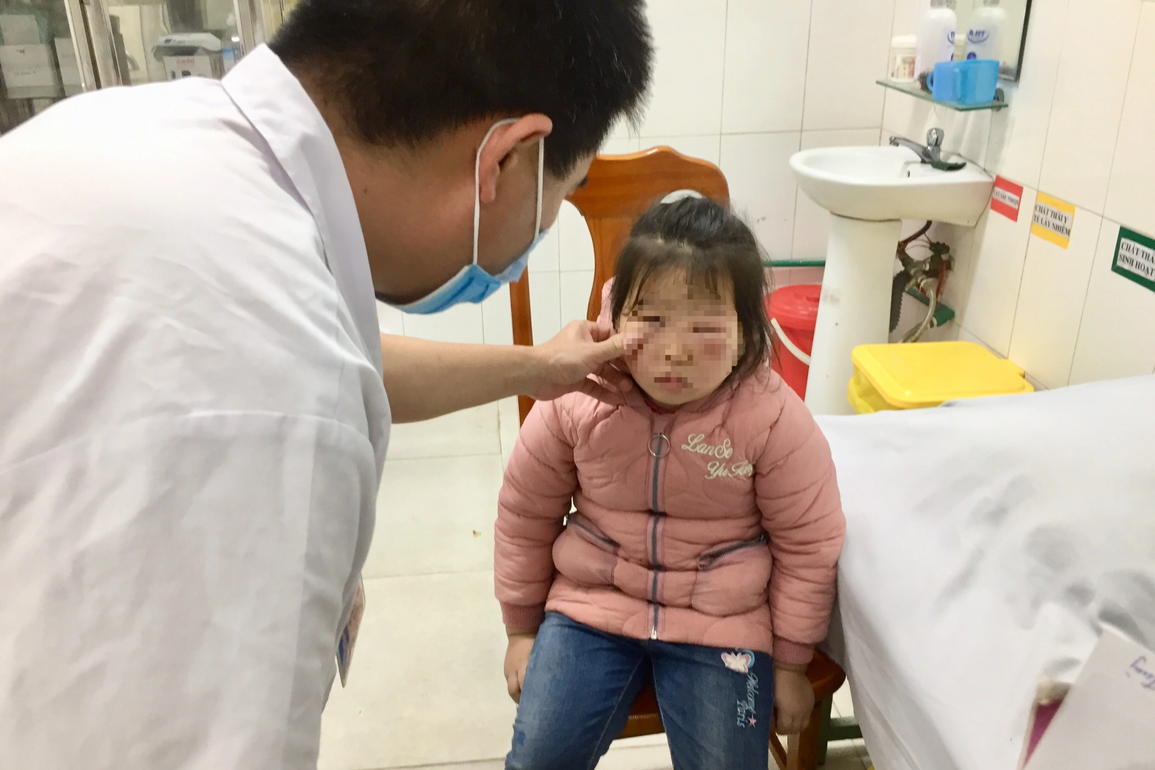 Rửa mắt bằng nước lá trầu, bé gái 6 tuổi phải nhập viện - 1