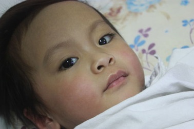 Bé Vàng Minh Châu đang được điều trị tại Bệnh viện hữu nghị Việt Đức