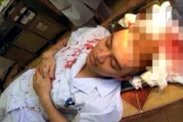 Hà Nội: Một bác sĩ Phó Trưởng khoa bị người nhà bệnh nhân hành hung