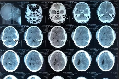 Đang đi đường gặp đàn trâu đuổi nhau, người đàn ông bị húc ngã đập đầu