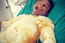 Vụ nhân viên điện lực bị phóng điện: Đình chỉ 8 người liên quan