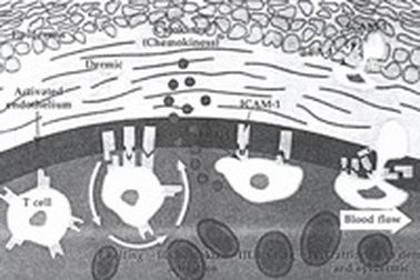 Hiểu biết về bệnh vẩy nến