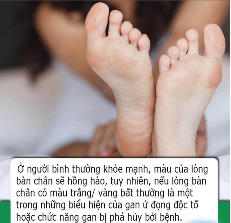 Bàn chân có 4 dấu hiệu này cho biết sức khỏe lá gan của bạn đang suy giảm - 1 Bàn chân có 4 dấu hiệu này cho biết sức khỏe lá gan của bạn đang suy giảm - 1