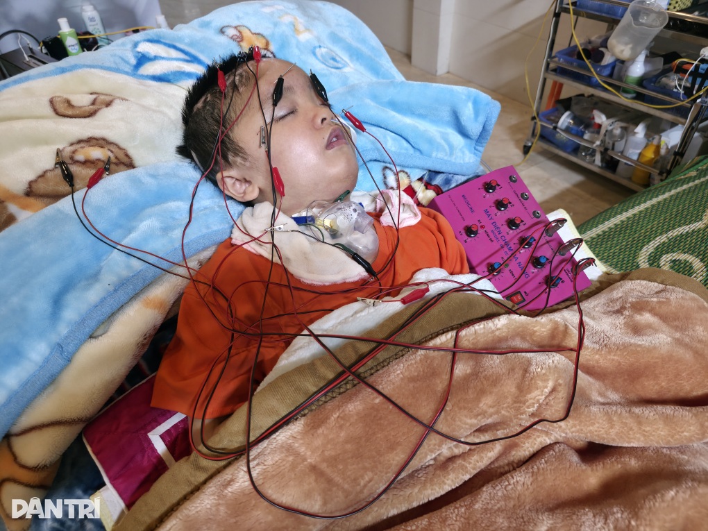 Quỹ Bảo trợ trẻ em Việt Nam hỗ trợ cậu bé 8 tuổi sống thoi thóp sau tai nạn - 2