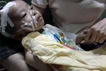 Sự sống mong manh của cậu bé 22 tháng tuổi 