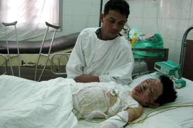 Đi "cứu diều", bé 13 tuổi nguy kịch vì điện cao thế giật 