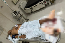 Truy tìm xe ben cán nát chân cụ ông 85 tuổi ở Bình Định