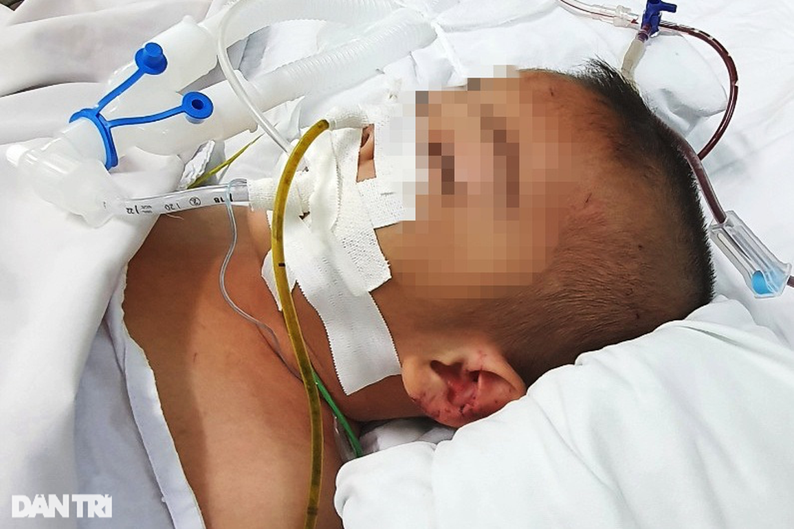 Công an điều tra vụ bé 5 tuổi bị thủng ruột, có nhiều vết bầm bất thường - 2 Công an điều tra vụ bé 5 tuổi bị thủng ruột, có nhiều vết bầm bất thường - 2