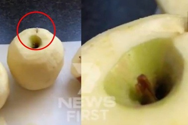 Úc: Tìm thấy cả kim khâu trong quả táo