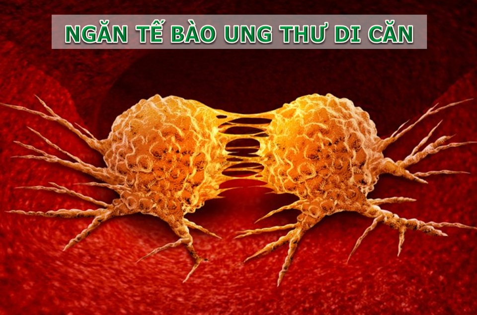 Giải pháp phòng, chống ung thư từ gốc hoàn toàn tự nhiên - 5 Giải pháp phòng, chống ung thư từ gốc hoàn toàn tự nhiên - 5