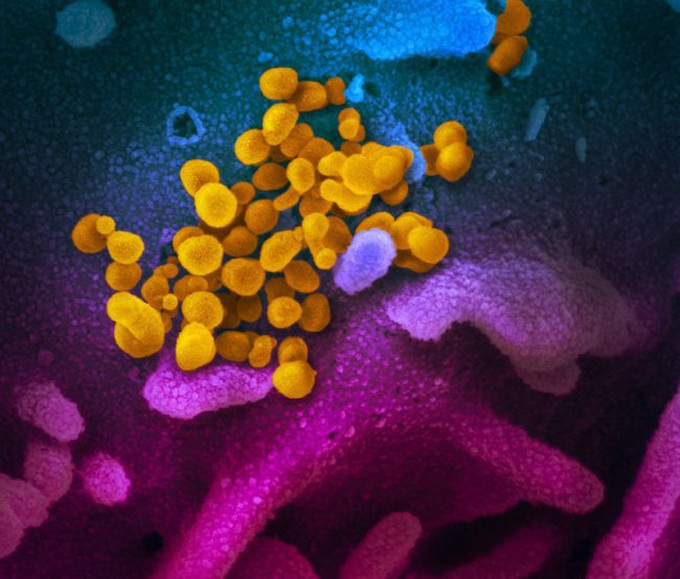 Hình ảnh thật sự của virus corona Covid-19 mới được trình diện - Ảnh 2. Hình ảnh thật sự của virus corona Covid-19 mới được trình diện - Ảnh 2.