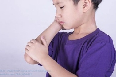 Tiên lượng điều trị ung thư máu trẻ em như thế nào?