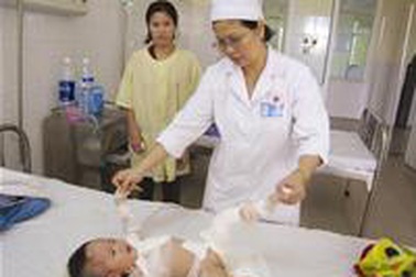 Tai nạn bỏng chỉ đứng sau tai nạn giao thông