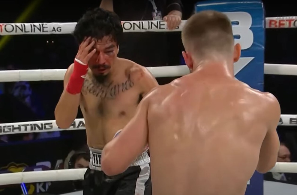 Chảy máu ở mắt, Đạt Nguyễn thất bại trong trận tranh đai hạng nhẹ boxing - 1 Chảy máu ở mắt, Đạt Nguyễn thất bại trong trận tranh đai hạng nhẹ boxing - 1