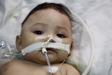 Bé H’Suha Niê bị não úng thủy đã ra đi mãi mãi