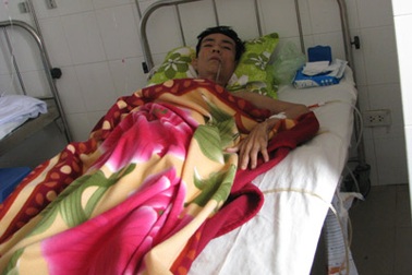 Lần đầu mổ nội soi cắt túi thừa thực quản 