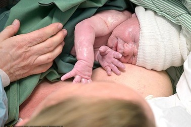 Người phụ nữ đầu tiên trên thế giới sinh con sau khi được ghép tử cung nhờ robot phẫu thuật