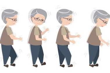 Bệnh run tay chân ở người già không đơn giản là do lão hóa