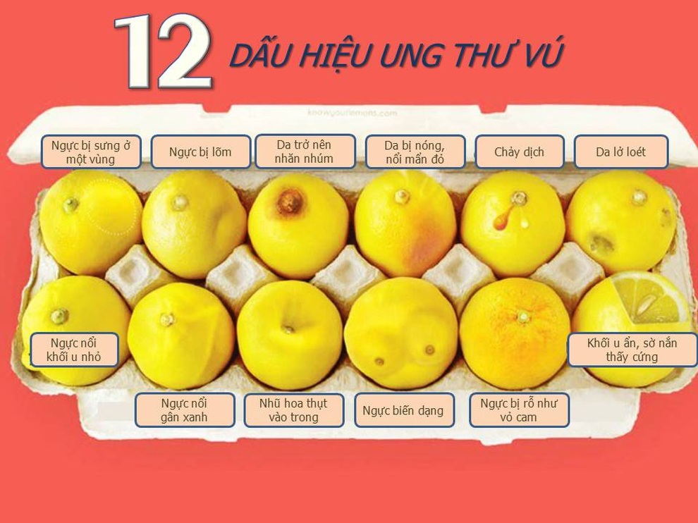 Phát hiện ung thư vú nhờ vào bức hình về 12 quả chanh - 2 Phát hiện ung thư vú nhờ vào bức hình về 12 quả chanh - 2