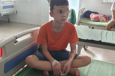 Cục Trẻ em vào cuộc vụ cháu bé bị chủ quán bánh xèo bạo hành