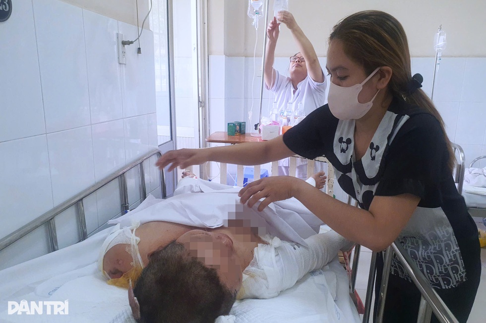 Người mẹ bị con trai tạt xăng đốt: Tôi không giận con - 5 Người mẹ bị con trai tạt xăng đốt: Tôi không giận con - 5